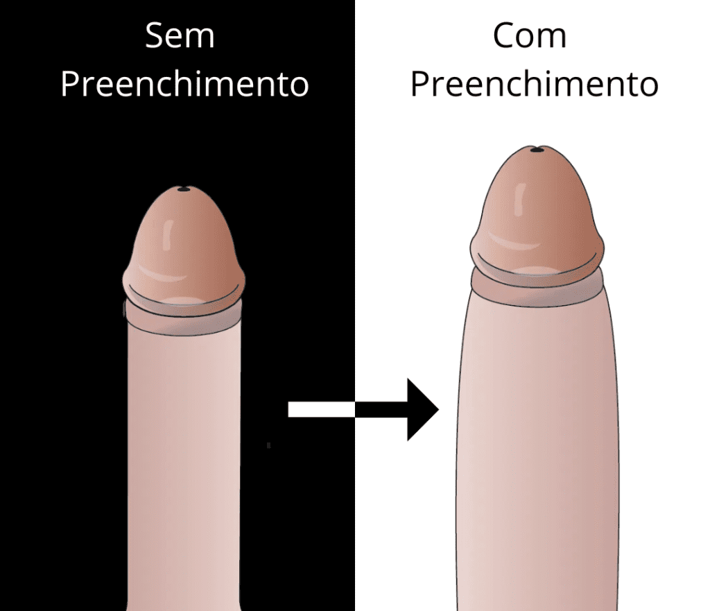 Antes e Depois